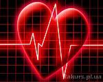 Click image for larger version.&nbsp;

Name:	73140644_1243246969_infarkt.jpg&nbsp;
Views:	99&nbsp;
Size:	35.7 KB&nbsp;
ID:	63674