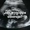 aborcjawyglad's Avatar